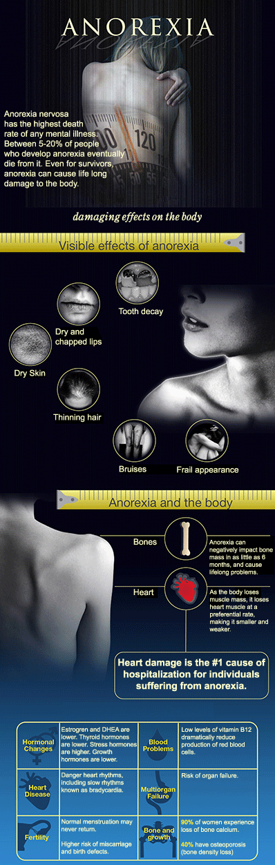 anorexia infographic